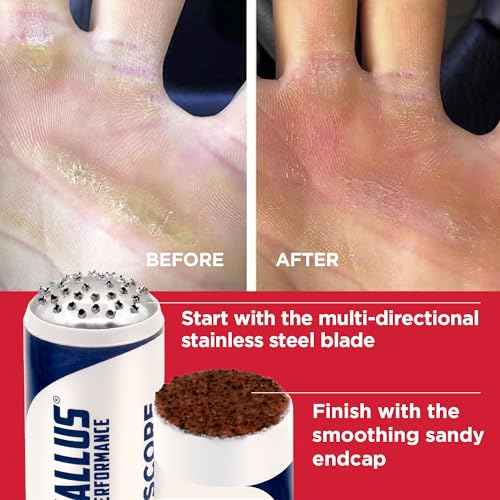 Callus Score ? Precision Hand Callus Remover for Athletes | Prevents Ripping | Callus Management for Weightlifters, Cross Training, Gymnastics and More | Callus Performance - we just do calluses