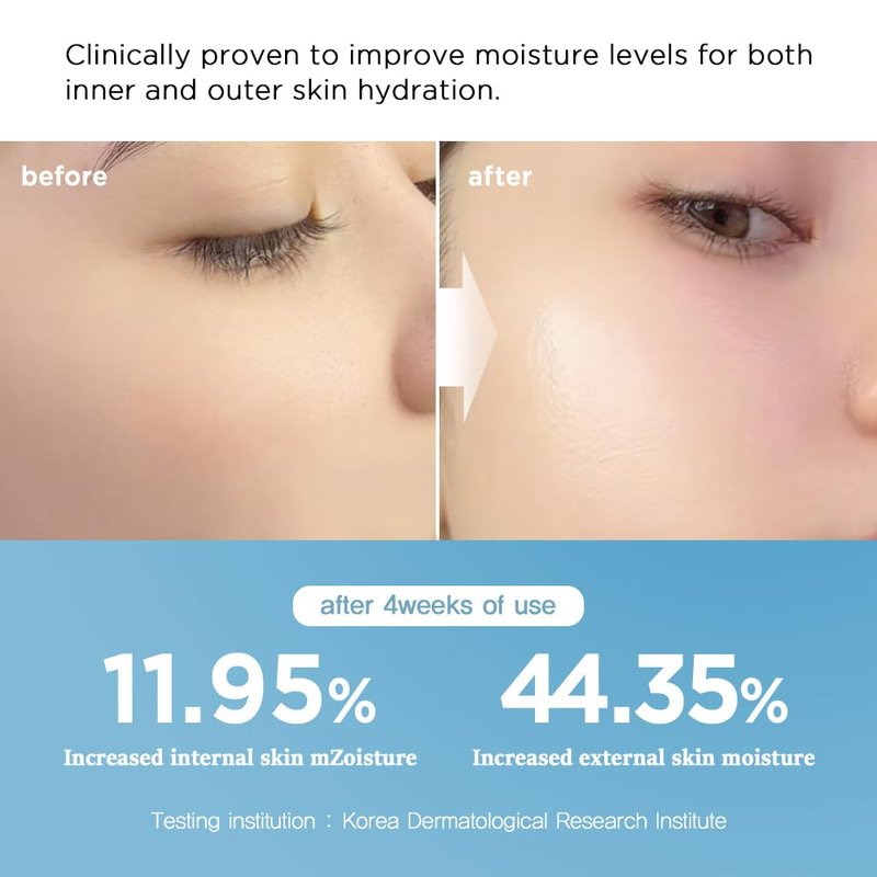 Nightingale Ecto-Hyaluronic Cream with 8 layer Hyaluronic Acid, Ectoin, Daily Face Moisturizer For Dry Skin, Fragrance Free, Hypoallergenic, Allergen Free, Cruelty Free, Vegan, Korean Skin Care