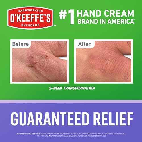 O'Keeffe's Working Hands Night Treatment Hand Cream for Extreme Dryness - 7 oz Tube (1 Pack) - Repairing Skincare for Cracked, Dry Hands