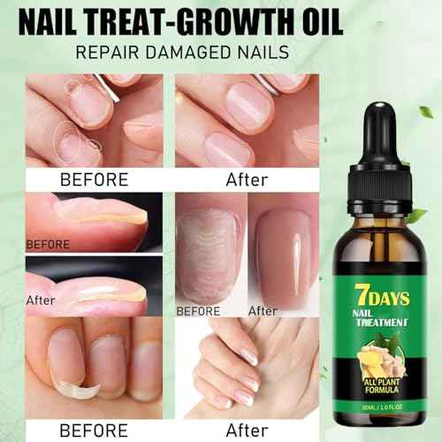 7 days Nail Treatment, 7 Days Ginger Nail Treatment, Multi-Purpose Nail Repair£¨2PCS)