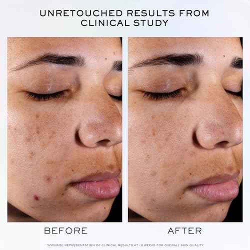 Lanc?me Clarifique Pro-Solution Face Serum - Facial Serum For Visibly Reducing Dark Spots & Acne Spots - With 10% PHA and Niacinamide