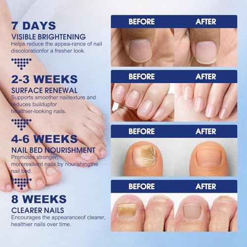 Toenail Fungus Treatment Extra Strength - 21 Pcs Fungal Nail Patches, 8-Hour Firm Adhesion, Nail Repair for Damaged Nails, Overnight Renewal for Men and Women