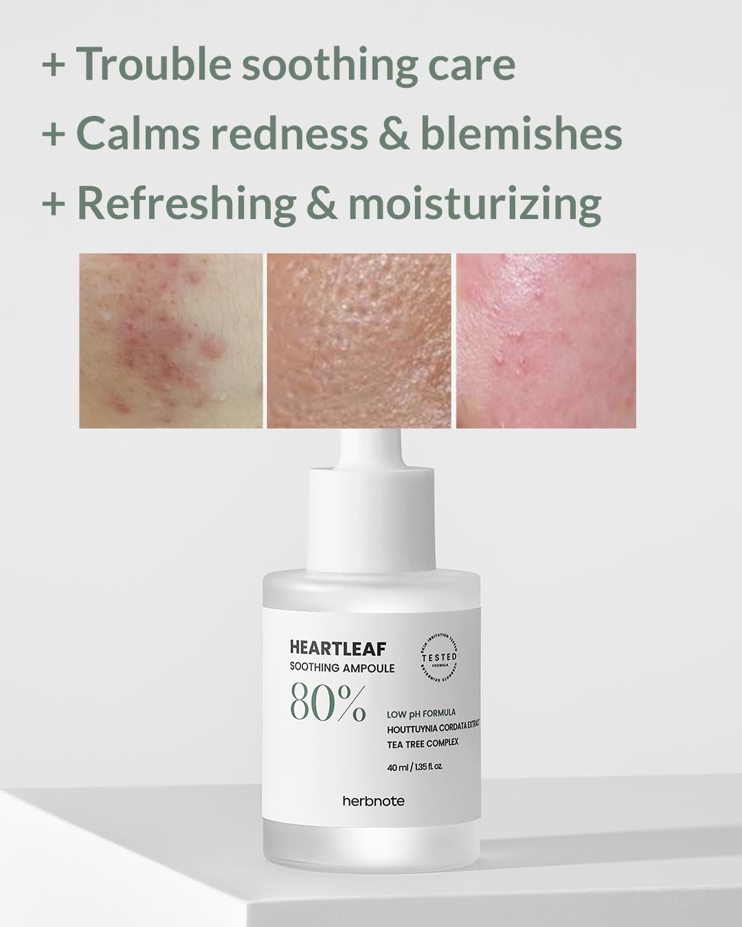 HERBNOTE Heartleaf Soothing Moisture Ampoule - Enriched with 80% Extracted Houttuynia Cordata, Teatree & Pantenol - Effective for Sebum Control - Clinical Tested, 1.35 fl.oz