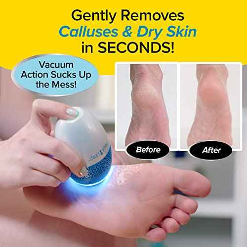 As Seen On TV Electric Callus Remover + Built-In Vacuum Sucks Up Shavings,Gently Removes Calluses & Dry Skin in Seconds, Mess-Free, Spins at 2000 RPMs, LED Light, 2 Speed Settings, 3.5"x 2.5"