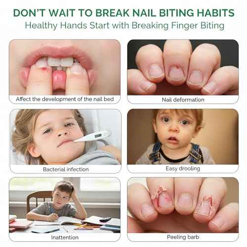 Nail Biting Treatment for Kids, Nail Biting Prevention, Stop Thumb Sucking Deterrent, Protect & Repair Nails, Safe & Mild Ingredients, Stop Nails Biting for Kids, Easy Brush, Day Night Care, 10 ML