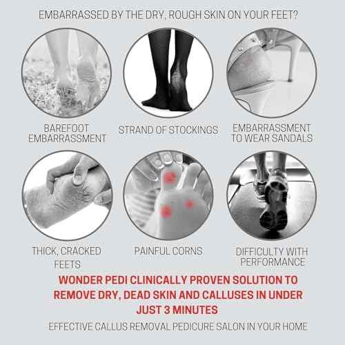Callus Remover - Three Minutes Quick Fix- Foot File Rasp - Instant Foot Exfoliating Softener Peel Spray, Heels Callus Scrubber File - Home Spa Pedicure Treatment. Wonder Pedi