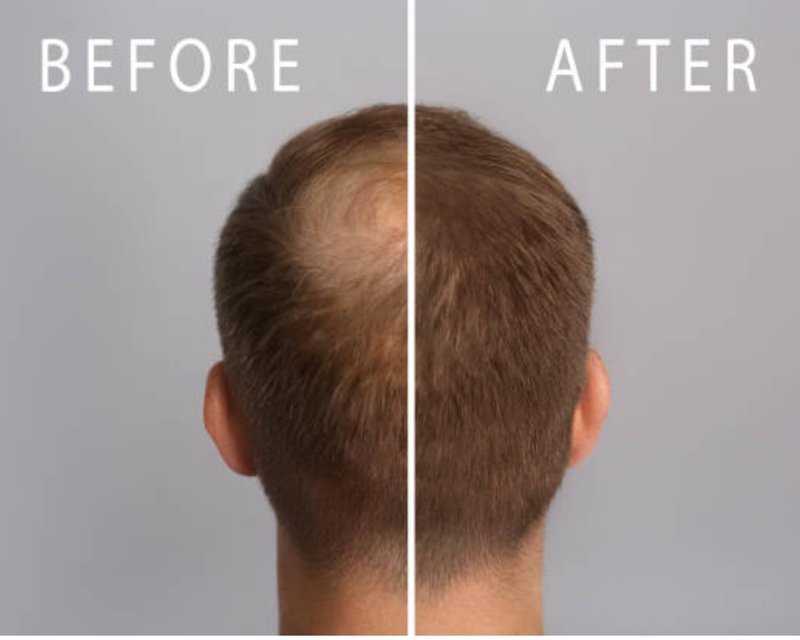 Mane Rain Hair Growth for Men and Women-Z-LAB27™ BioActive Plant Formula Awakens Hibernating Roots-Stimulates and Nourishes Scalp-Blocks DHT-Fuller Thicker Hair-Made in USA