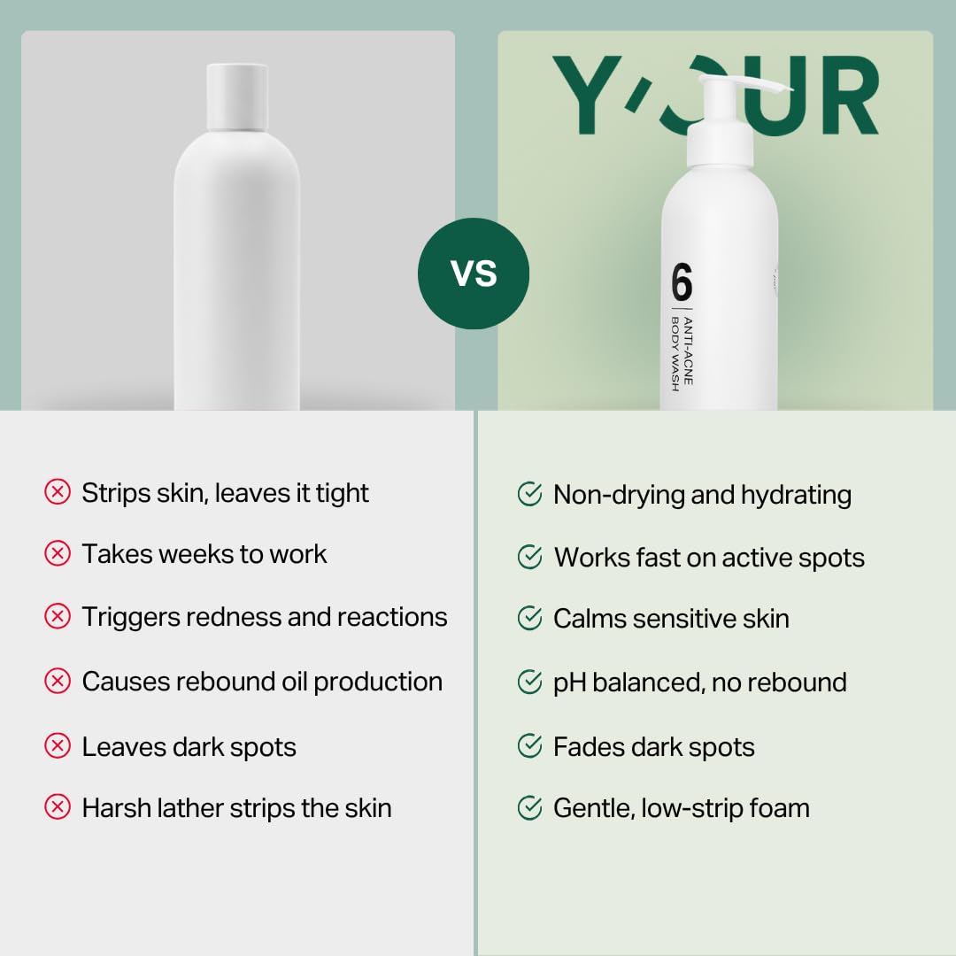 Y'OUR Aloe Vera Anti-Acne Body Wash | Gentle & Non-Drying Formula | Smooths Texture & Evens Tone | Clears Bacne & Breakouts for Women + Men, Paraben & Sulfate Free