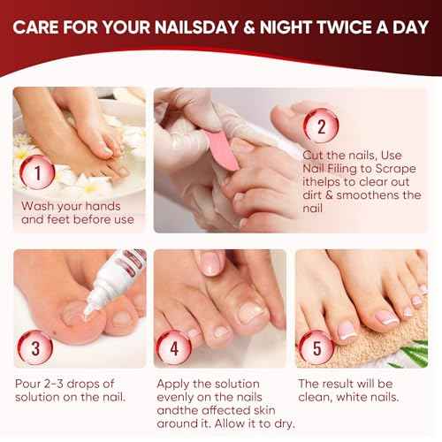 Toenail Treatment,Gentle Formula, Effectively Improves Nails for a More Beautiful Appearance