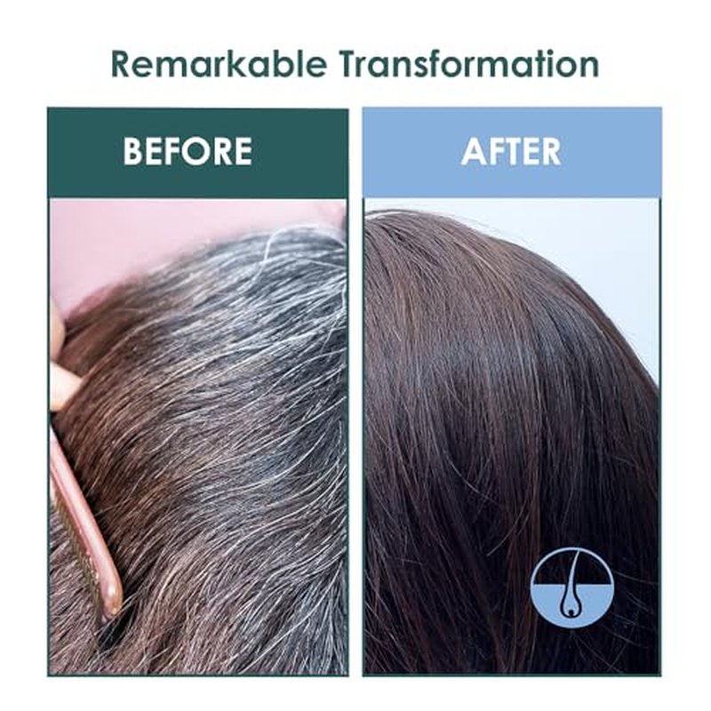 SH-RD Intensive Scalp Essence for Anti-Aging | Promotes Hair Growth with Amino Acids, Protein, Vitamin B5 | Lightweight Serum - 50ml/1.69oz