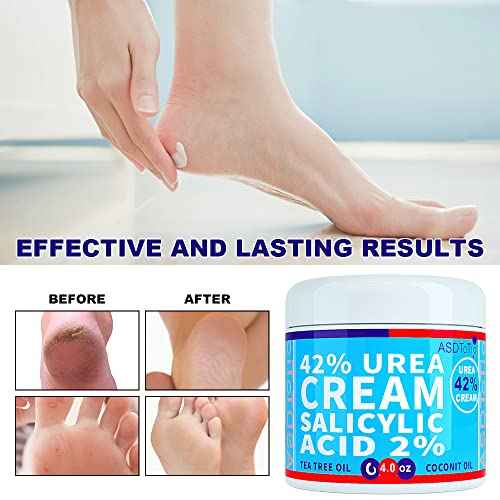 Urea Cream 42% - Premium Urea Foot Cream - With 2% Salicylic Acid, Tea Tree Oil, Shea Butter, Aloe Vera - For Feet, Hands, Heels, Elbows, Knees and More - 4 oz