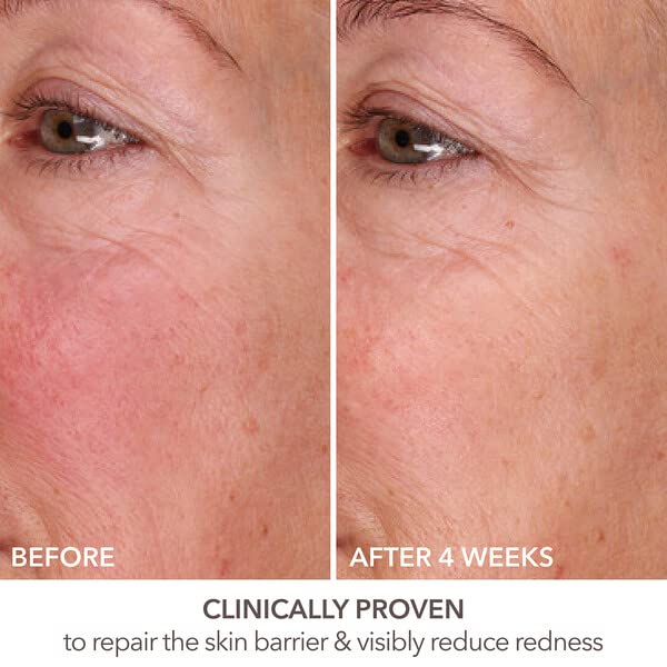 Dr. Dennis Gross DermInfusions Fill + Repair Serum - Plumps & Repairs Fine Lines | 1 oz
