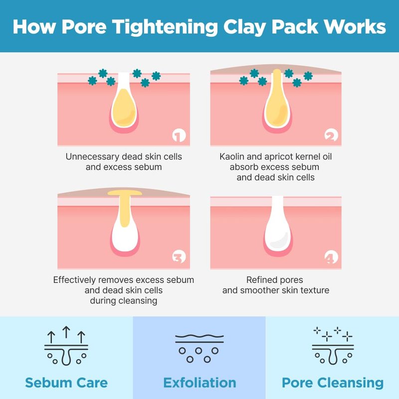ISOI Pore Tightening Clay Mask for Face, Natural Kaolin & Plant-Based Formula for Tightening, Lifting, Exfoliating & Sebum Control, Moisture-Balancing, Korean Clay Mask for Pores (3.38 fl. oz, 100ml)