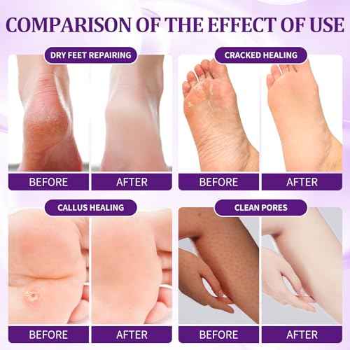 Pedicure Kit Foot Soak Set: Bubble Salt, Sugar Scrub, Massage Mask, Massage Lotion in a Box, 4 Step Foot Spa Kit for Dry Feet,Tired Feet£¨1 Set Lavender)