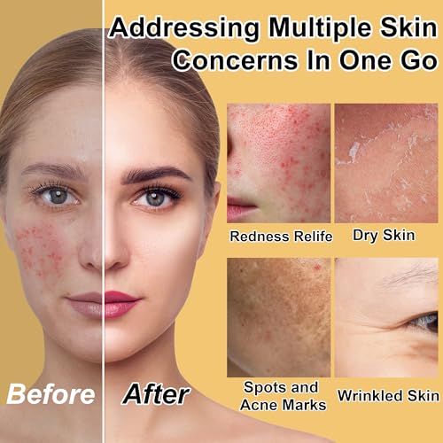 Skin Care Set for Teens Women,Anti-Aging Deeply Hydrates Repairs Skincare Gift Set for All Skin,Facial Skin Care Products Routine Kit Christmas Beauty Gift Set for Women