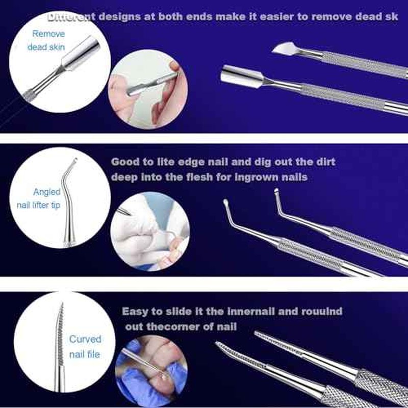 Ingrown Toenail File and Lifters Set(6pcs), Professional Pedicure Tool Toenail Grooming Kit, Ingrown Toenail Treatment Pedicure Kit, Under Nail Cleaner Tools (6PCS)