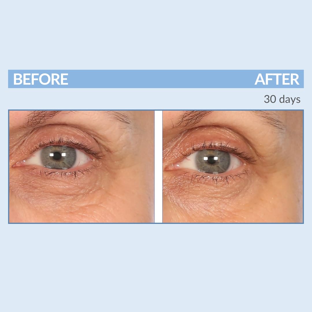 Serious Skincare - EYETALITY Morning Under Eye Cream for Dark Circles & Puffiness, Anti-Aging Daily Wrinkle Cream, Line Smoothing Skin Care Treatment for Women and Men - Coffee Bean Extract 0.5 oz