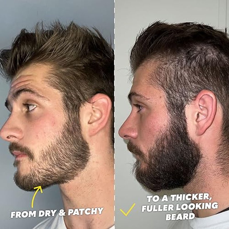 The Beard Club Signature Beard Growth Kit - Derma Roller, Beard Growth Oil, Beard Growth Vitamins, Vitamin Spray & Beard Brush - Gift Set