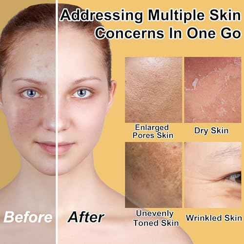 Skin Care Set for Women Teen 6 Pcs - Hydrating & Anti-Aging Facial Routine Skincare Products,Cleanser,Toner,Retinol Serum,Niacinamide Hyaluronic Acid Serum & Face Cream - Gifts Women Christmas