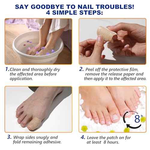 Toenail Treatment Extra Strength, 32 PCS Nail Patches 8-Hour Overnight Nail Repair Effortless Hydrogel Nail Care and Repair for Damaged Nails Overnight Renewal for Men and Women
