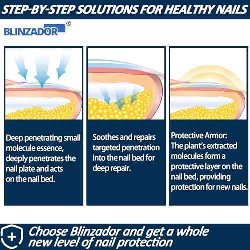 Toenail Treatment Extra Strength - Best Toenail Treatment Spray | Nail Treatment for Weak and Damaged Nails - Natural Plant Ingredients, Fast-Drying, Easy-To-Use | 1oz (30ml)