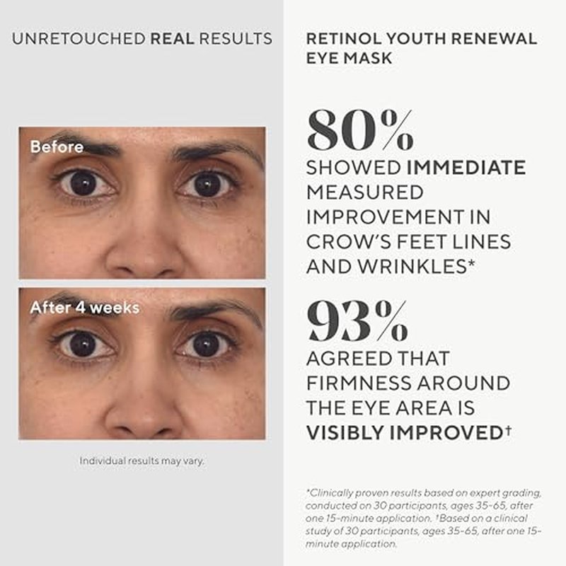Murad Retinol Youth Renewal Eye Masks ? No-Slip Full Absorption Bio-Cellulose Under Eye Patches with Retinol, Blue Agave, & Passionfruit for Lines, Wrinkles, Puffiness