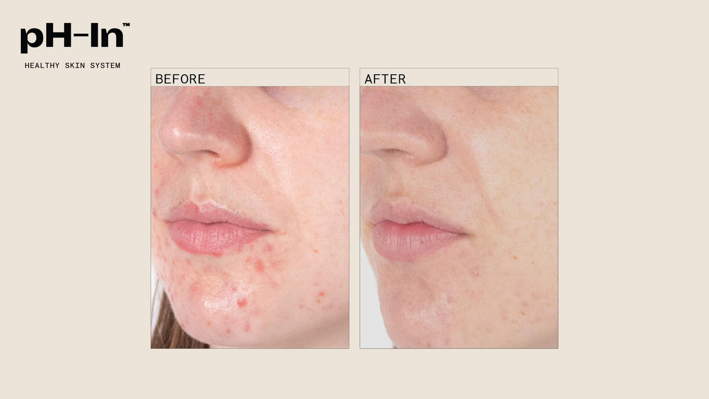 pH-In 3 Step Healthy Skin System