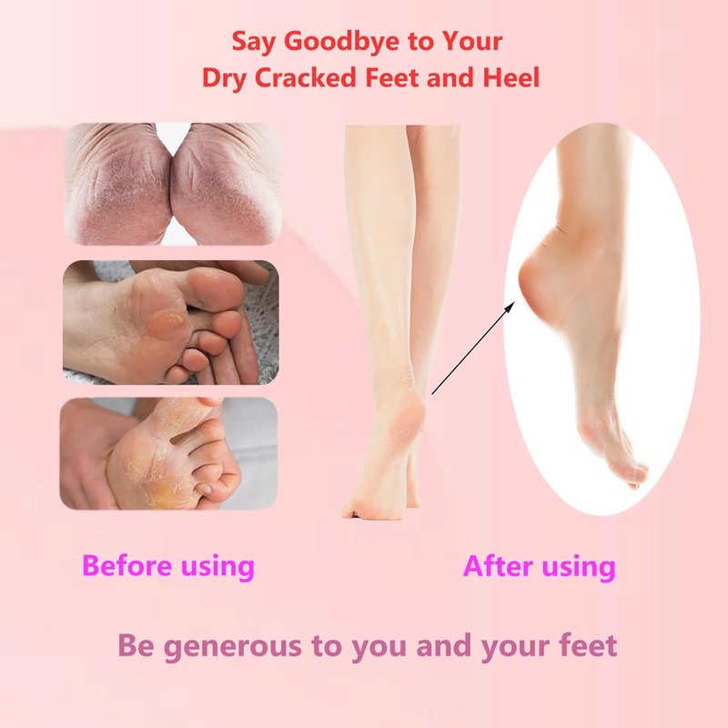 Electric Foot Callus Remover - 1200RPM Adjustable Speed | Aluminum File with 60 Sandpaper Discs - Pink