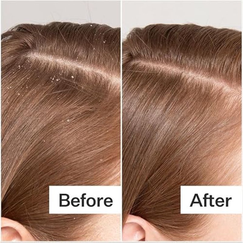 Scalp Serum for Thinning Hair