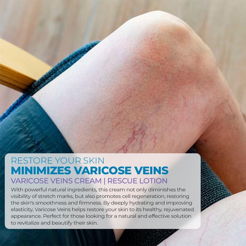 CLG Skincare Varicose Veins Cream - Advanced Plant-Based Lotion for Improved Circulation & Skin Firming | 8 oz
