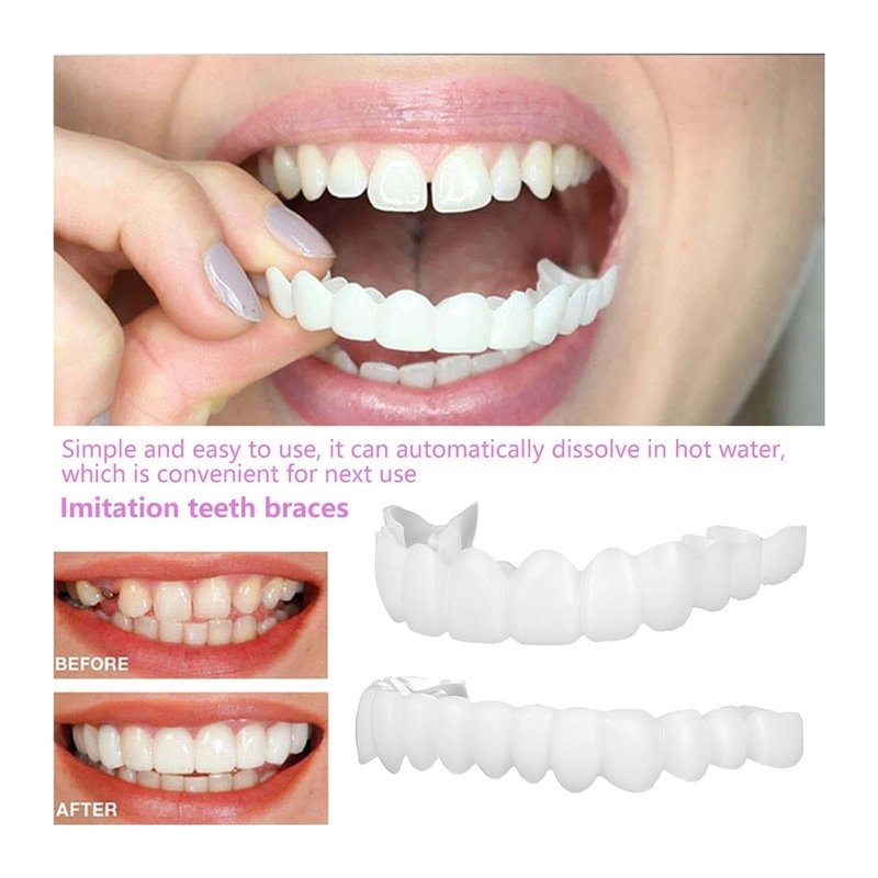 2 Pairs, Regain Confidence, Temporary Nature and Comfortable,Adjustable for Men and Women (1)