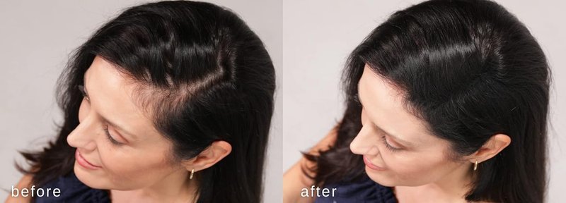LUXE Hair Building Fibers - Thickening Fibers for Fuller Hair - Hypoallergenic & Dermatologist Tested | Dark Brown, 2-Month Supply