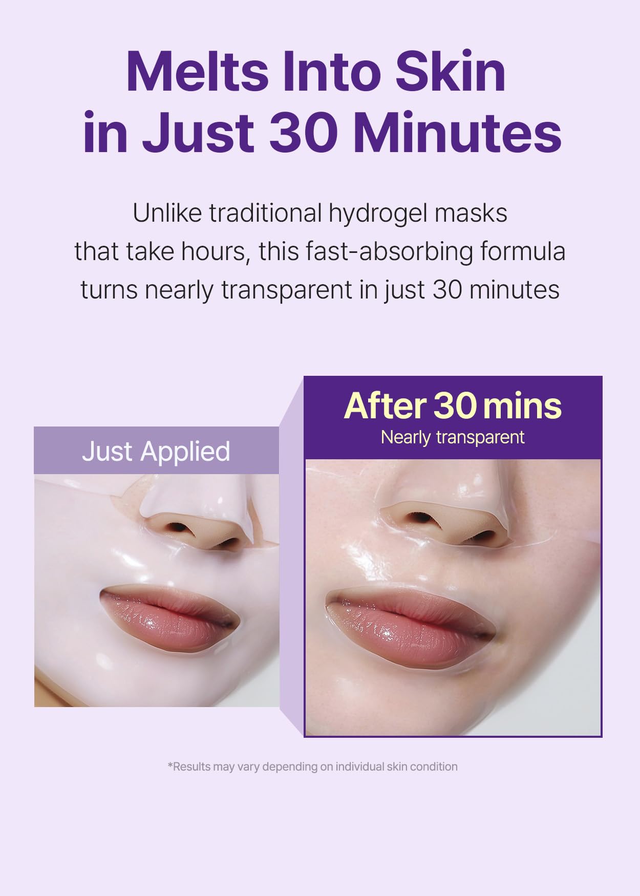 SNP 10,000ppm Deep Collagen + PDRN + Retinol Hydrogel Mask | 8 Layer 125Da Collagen Face Mask | Overnight Facial Mask | Patent Skin Hydration | Hydrating Facial Mask | Face Mask Skin Care | 4 Sheets