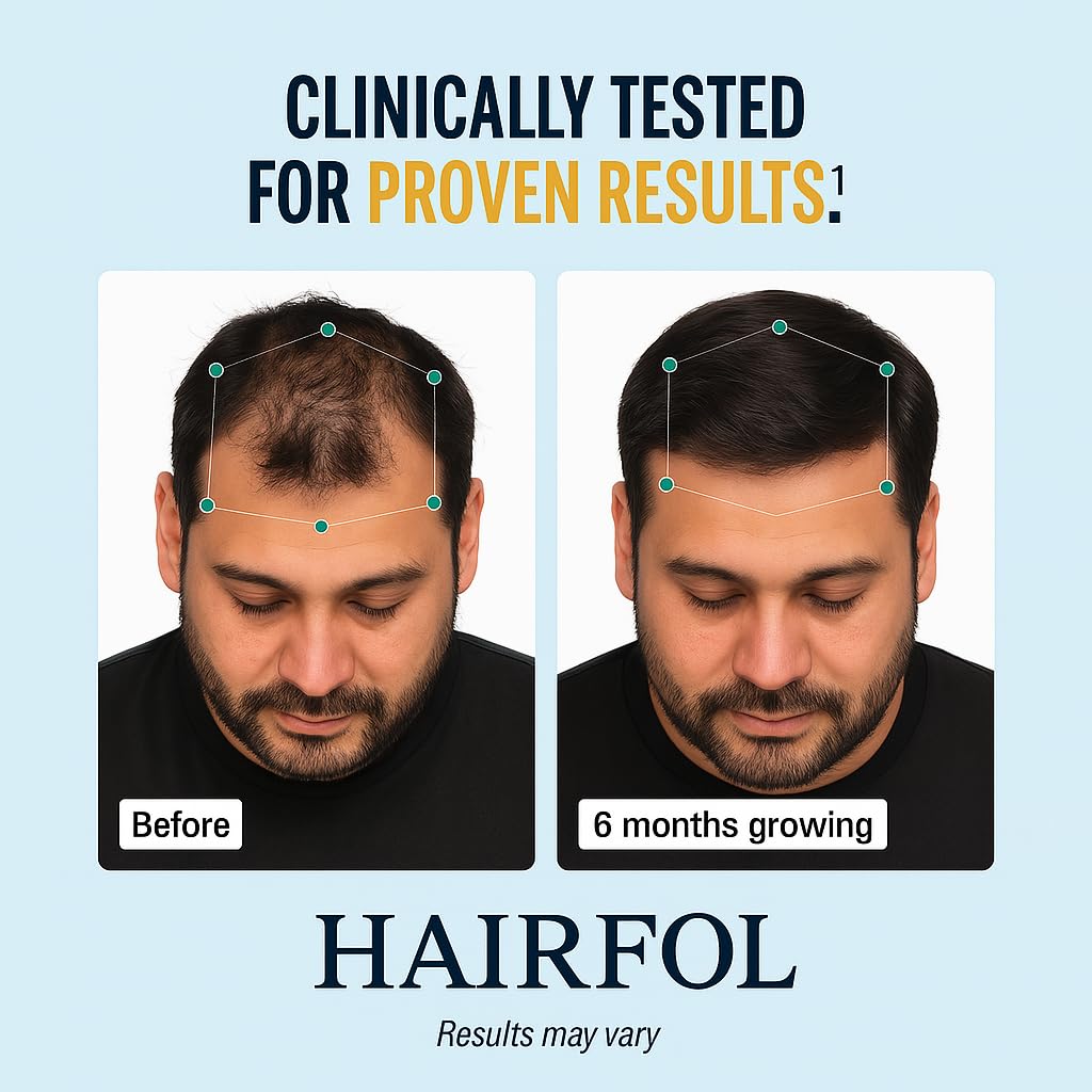Hairfol Men's Hair Growth Supplement – Clinically Tested Hair Growth Vitamins for Men, Thicker Hair & Scalp Coverage, Hair Regrowth Support for Men – Stronger, Fuller Hair – 1 Month Supply