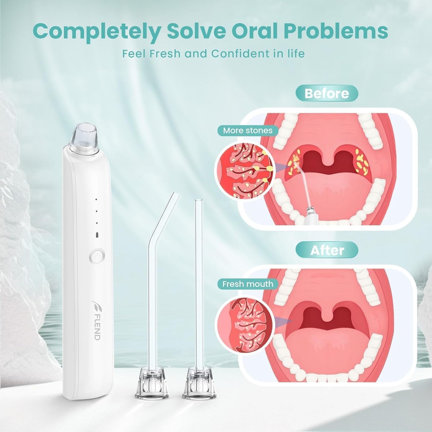 Tonsil Stone Remover with 5X Magnifying Glass Tonsil Stone Removal Kit 3 Suction Modes LED Light Bad Breath Water Flosser