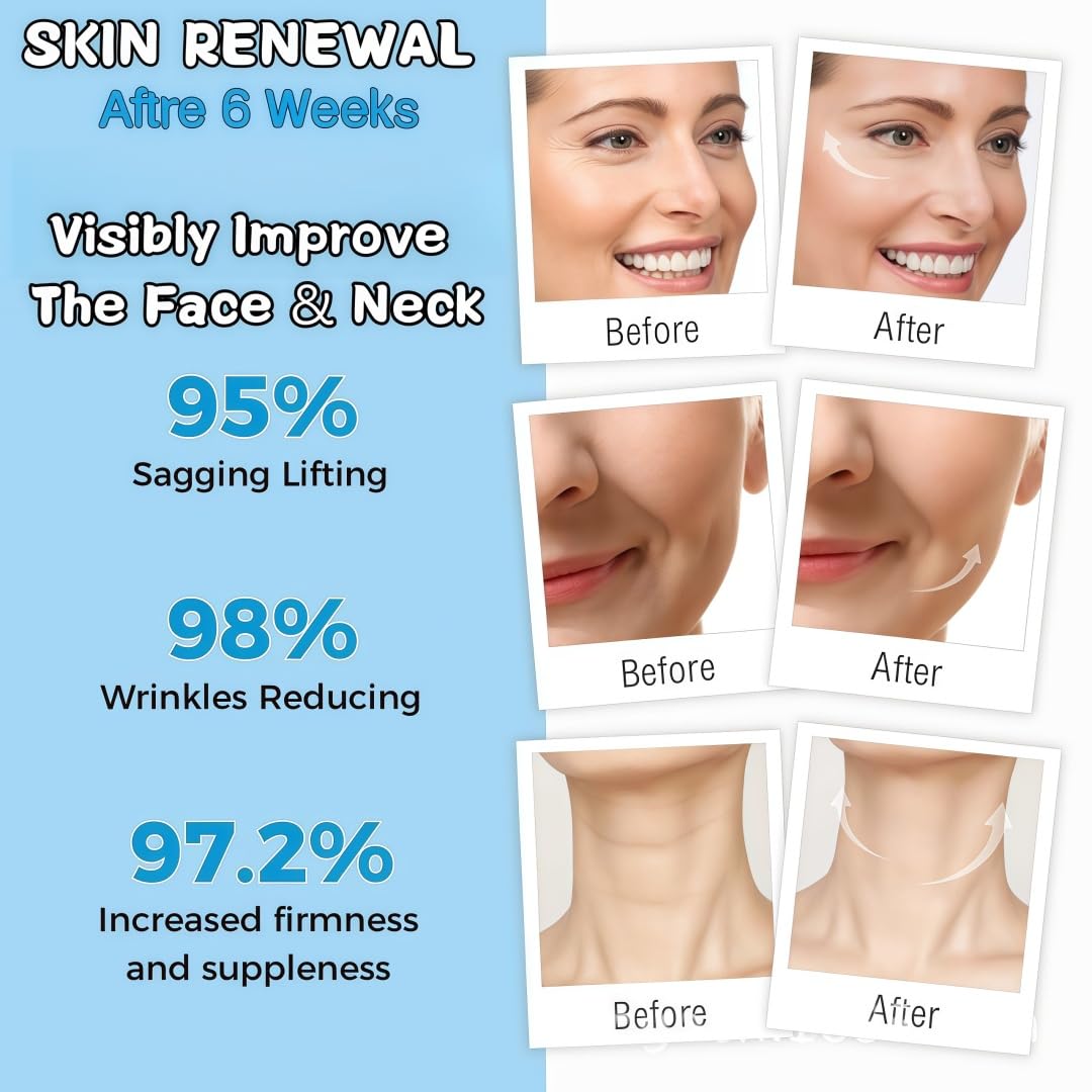 Collagen Face Cream with Retinol, Hyaluronic Acid & Niacinamide - Anti-Wrinkle, Firming & Hydrating Moisturizer with Plant Stem Cell Extract - Airless Pump for Day & Night Use - For All Skin Types