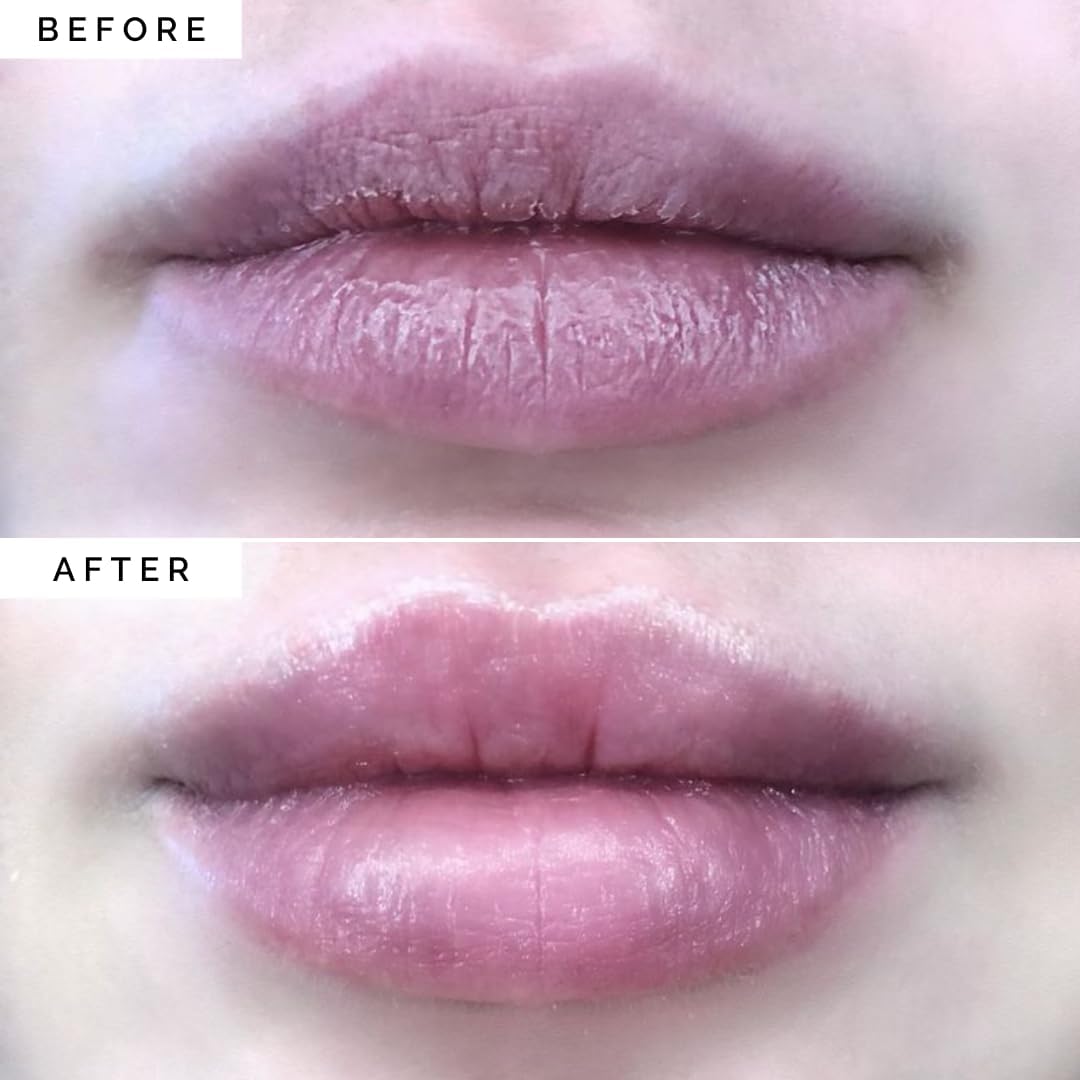 Elizabeth Mott Lip Sleeping Mask – Overnight Treatment with Peptides to Repair, Hydrate & Restore Dry, Chapped, Cracked, Peeling Lips – Moisturizing Collagen Balm to Soften, Smooth, Plump 0.71 oz