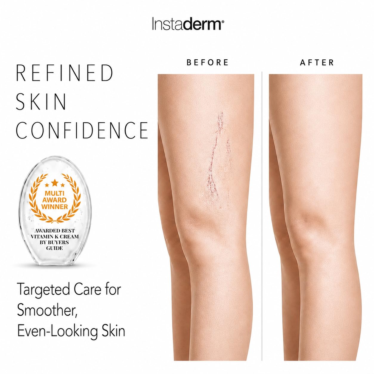 Vitamin K Cream-Revitalizing Formula with Arnica for the Appearance of Brusing, Spider Veins, Broken Capillaries, Uneven Tone & Dark Spot – Under Eye Cream for the Look of Dark Circles & Puffiness