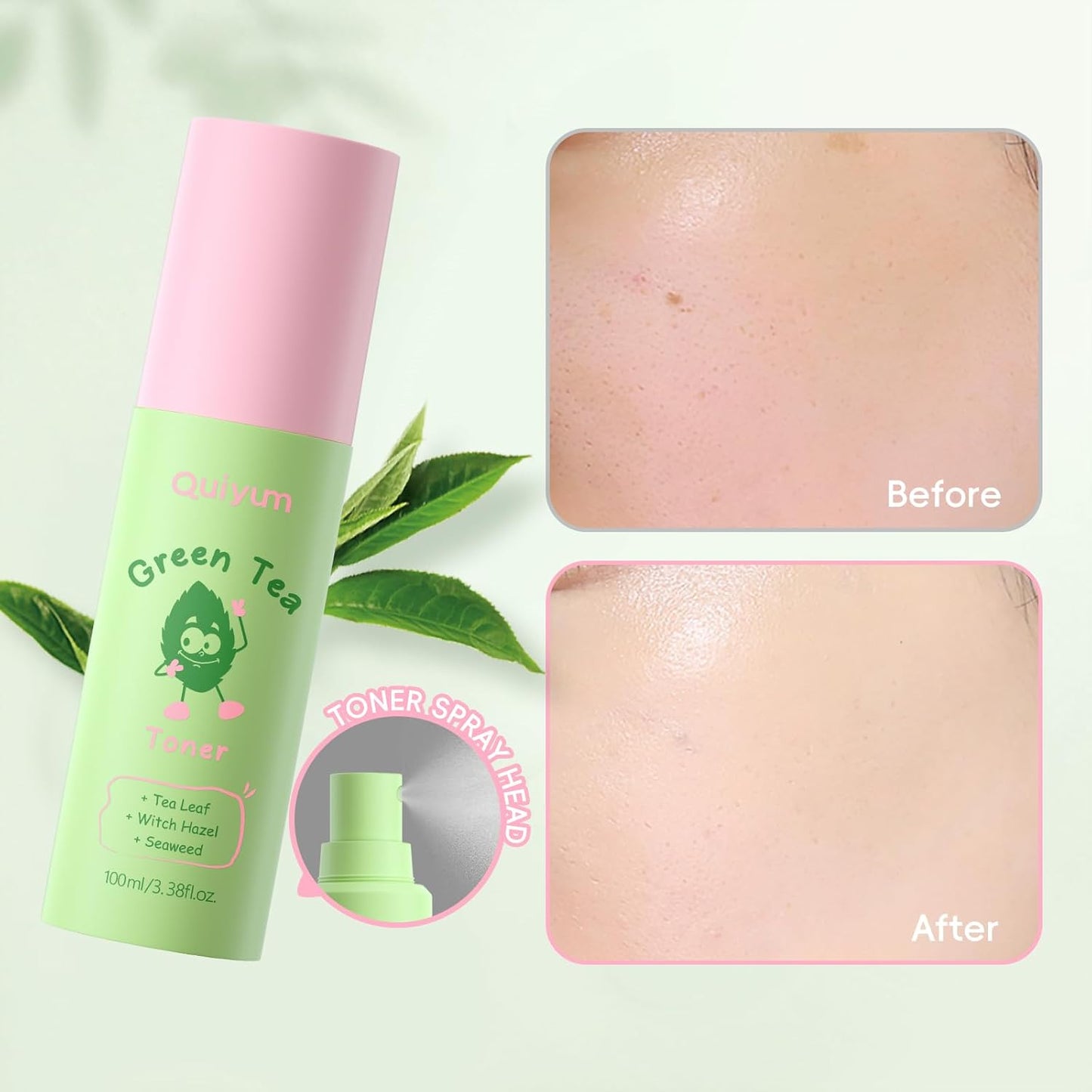 Green Tea Skin Care Gift Set | Facial Skincare for Teens - Oil Control, Moisturizing Toner, Cleanser & More