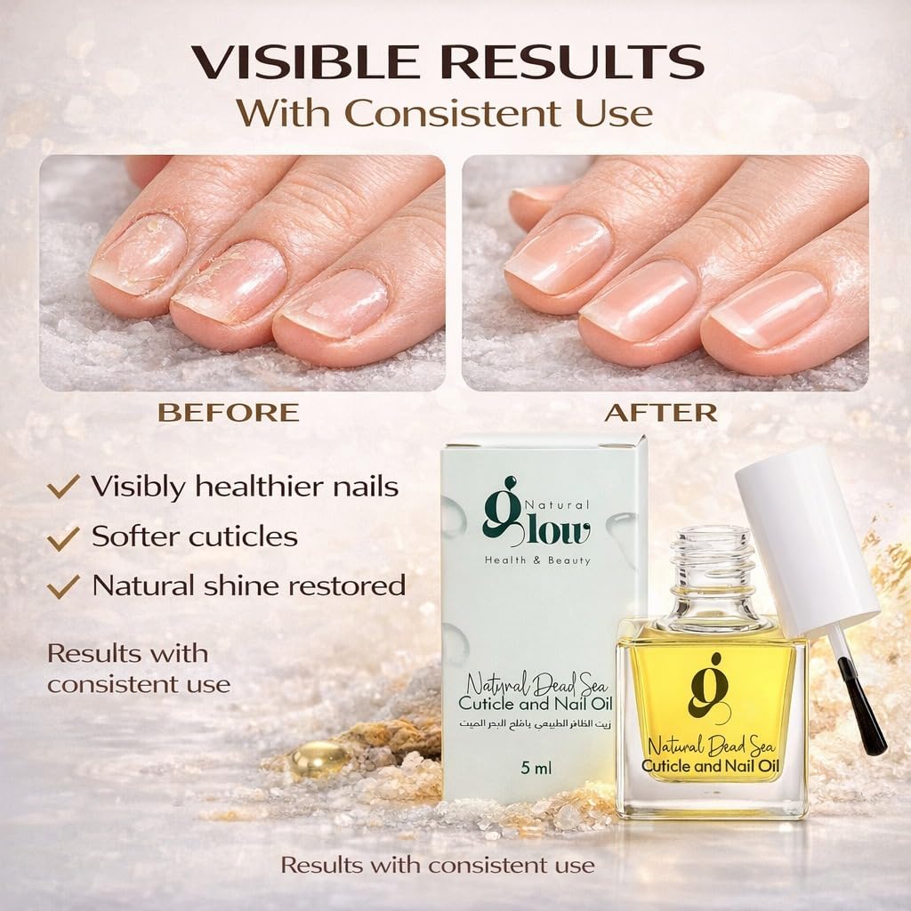 Dead Sea Cuticle & Nail Oil 5ml | Strengthens Nails & Deeply Moisturizes Dry, Cracked Cuticles | With Jojoba, Argan, Olive, Almond & Castor Oils + Vitamin E | Nail Repair & Growth Treatment