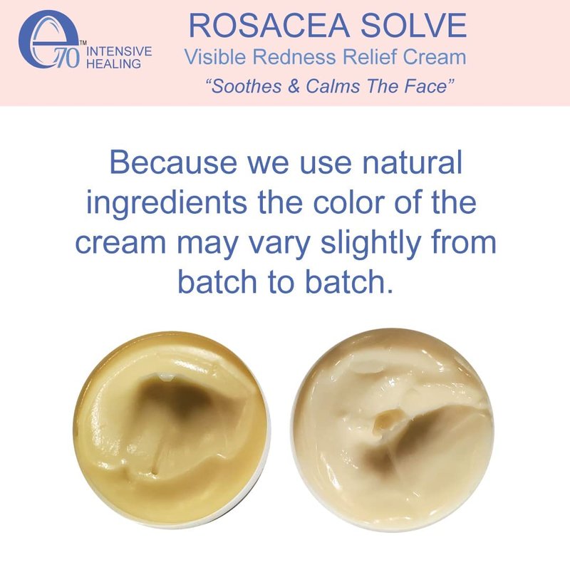 Rosacea Treatment for Face Skincare Cream for Women & Men (Pack of 2) - Gentle Moisturizer Redness Reducing Skin Care - with Aloe Vera & Hyaluronic Acid - Day-Night, Made in USA by e70 (2.25 fl. oz.)