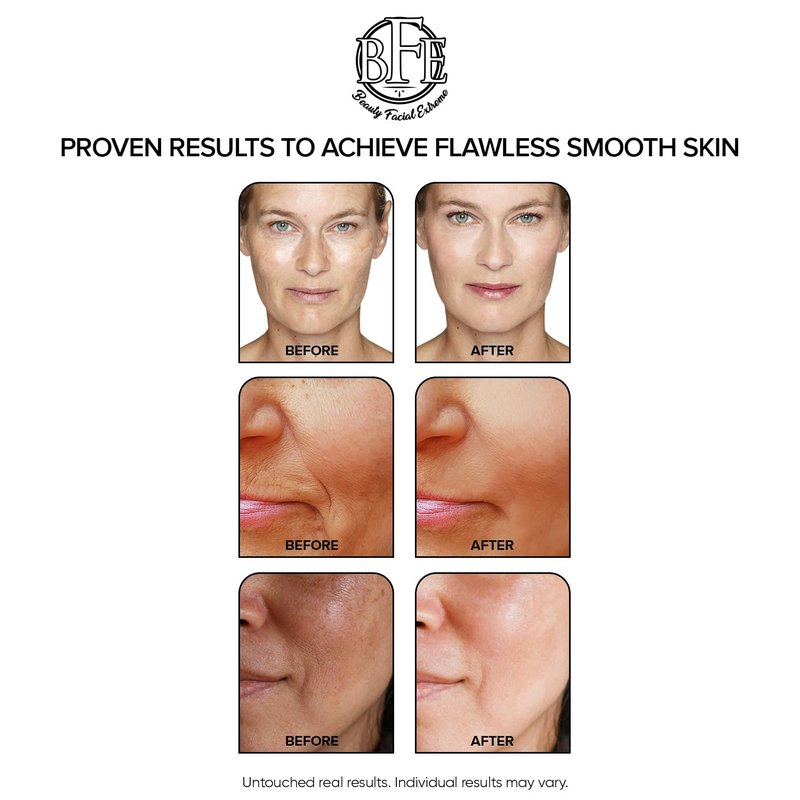 Glycolic Acid 15% Anti-Aging Wrinkle Cream Reduces the Appearance of Fine Lines, Wrinkles, Age Spots, Dark Spots & Improves Dull Looking Complexion. Includes A.H.A & Green Tea Moisturizer.
