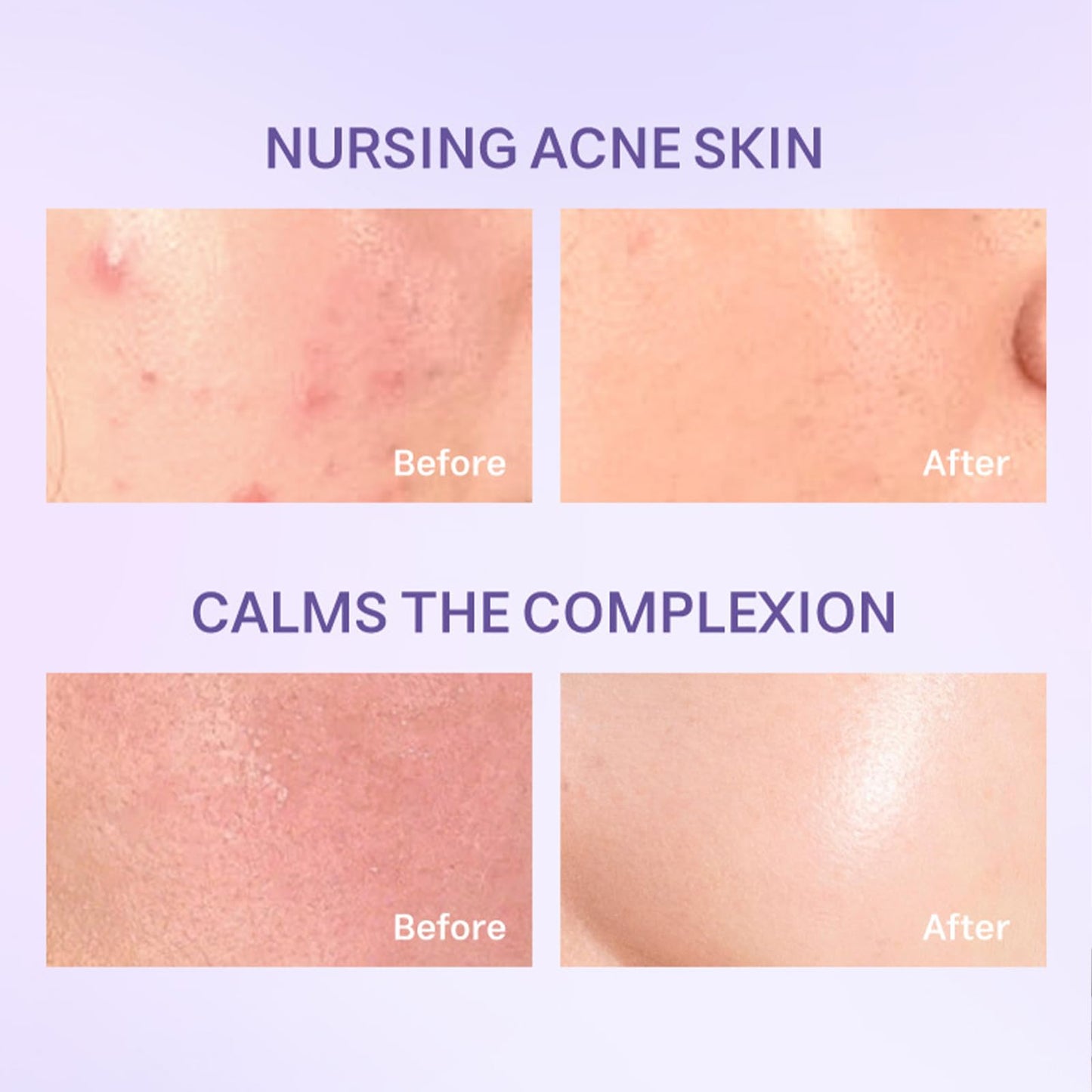 Gentle Face Cleanser, Hydrating Facial Cleanser for Sensitive Skin with Blueberry,Ceramides and Asiatica Cartel, Barrier Repair Hydrating Face Wash for Dry Skin,Oil Skin and Sensitive Skin