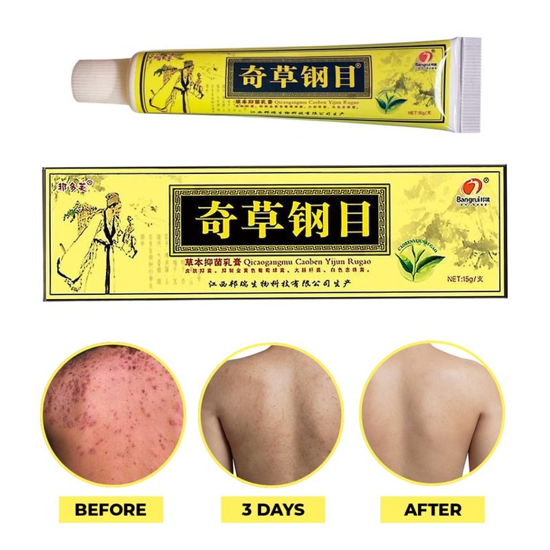 QICAOGANGMU Official Seller Chinese Herbal Cream - Steroid Free, Natural Relief for Skin Issues - Pack of 5
