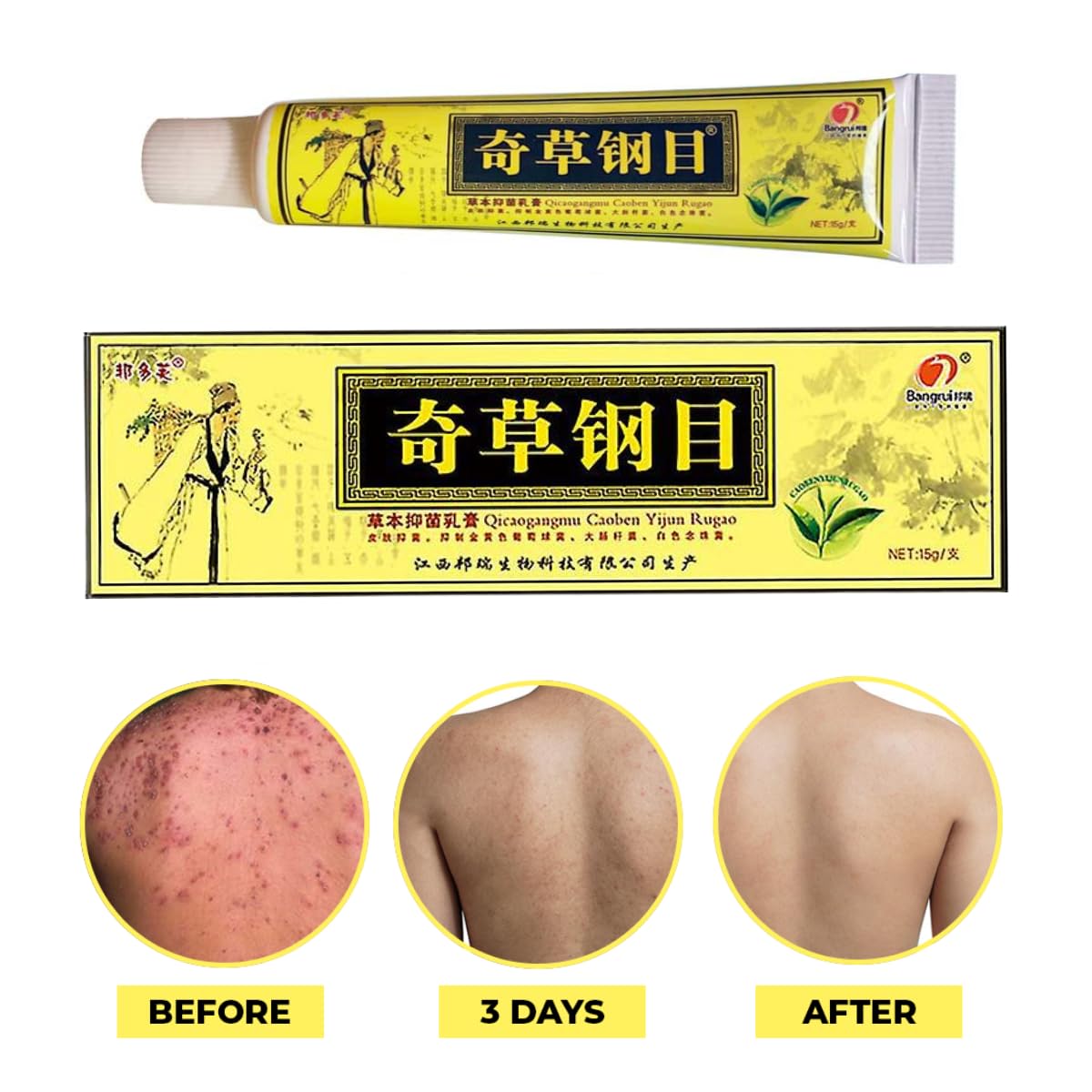 QICAOGANGMU Official Seller Chinese Herbal Cream - Steroid Free, Natural Relief for Skin Issues - Pack of 5