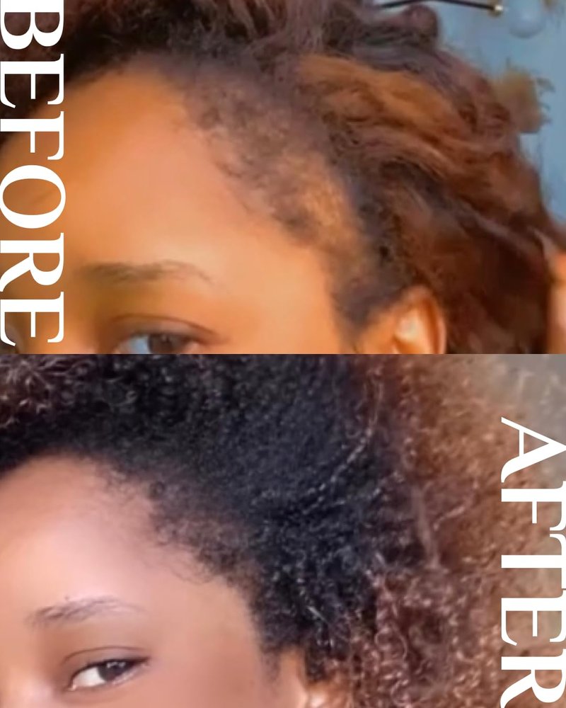 Hair Growth Oil with Rosemary & Peppermint - All-Natural Formula for Thicker Hair | 2oz