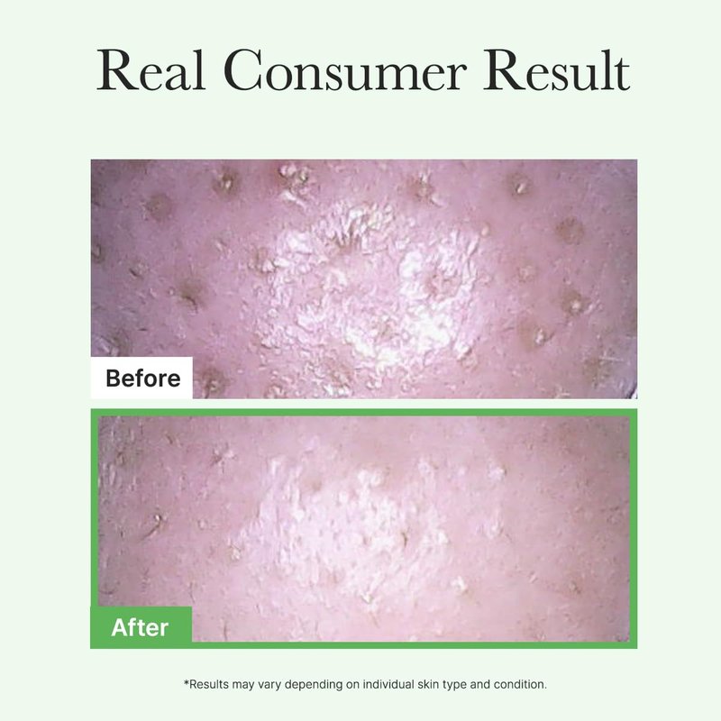 ARENCIA Pore Melt Cleansing Oil - Non-Comedogenic Makeup Remover with Rice Amino Acids & Vitamin E | 6.76 fl oz