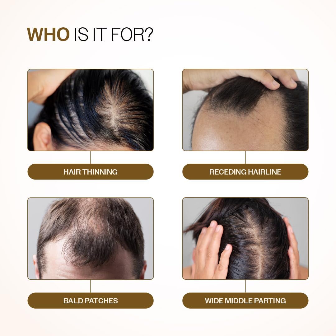 Bare Anatomy Advanced Hair Growth Serum Roll-On| 3% Redensyl + 4% Anagain + 2% Baicapil + 5% Rosemary, Rice Water, Biotin & Saw Palmetto| Reduces Hair Fall, Supports Hair Growth for Men & Women | 25ml