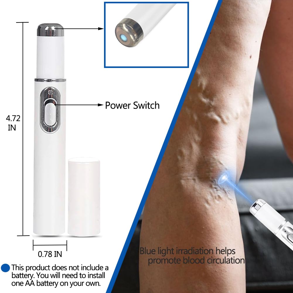 etitek 2 Pack Varicose Veins Treatment for Legs,Varicose Veins Blue Light Therapy Set Fast Soothe Blood Circulation Natural Formula Smooth Skin