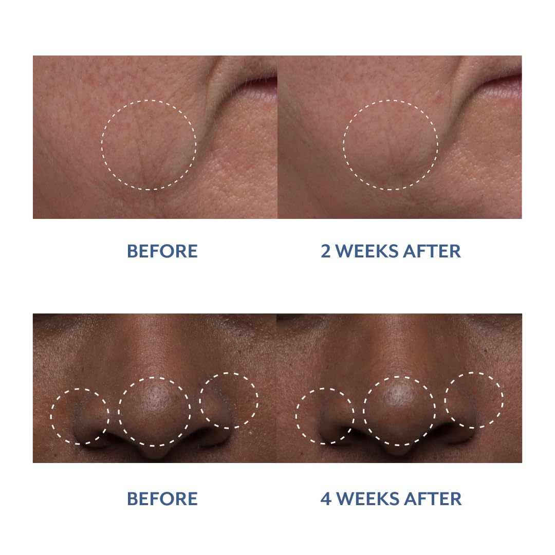 Bloomeffects - Natural Tulip Dew Drops Multi-Nutrient Serum | Cruelty-Free, Non-Toxic, Clean Beauty (1.0 oz | 30 ml)